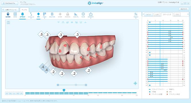 「クリンチェック」で治療前に正確なシミュレーション